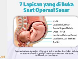Inilah 7 Lapisan yang Dibuka Saat Operasi Caesar: Penjelasan Lengkap